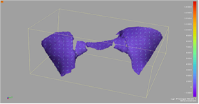 DIC-on-pelvis-bone DIC-on-pelvis-bone